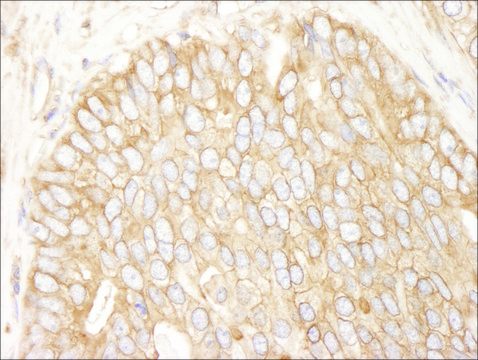 Mouse anti-Rictor Monoclonal Antibody, Affinity Purified Powered by Bethyl Laboratories, Inc., clone IG3P2C9