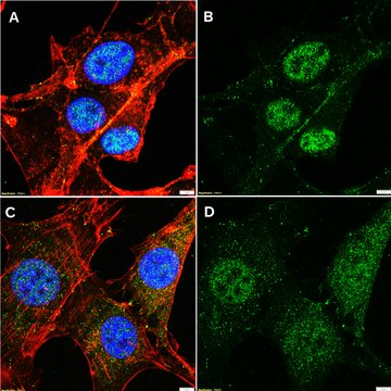 Anti-p-PKC&#946; (Ser660) Antibody, clone 2C11 ZooMAb&#174; Rabbit Monoclonal recombinant, expressed in HEK 293 cells