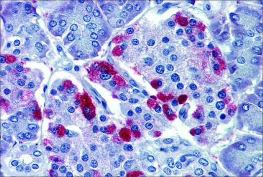 Anti-GNAS antibody produced in rabbit affinity isolated antibody