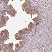 Anti-ATAT1 antibody produced in rabbit Prestige Antibodies® Powered by Atlas Antibodies, affinity isolated antibody, buffered aqueous glycerol solution