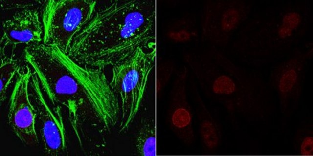 Anti-O-Linked N-Acetylglucosamine Antibody, clone RL2 clone RL2, from mouse