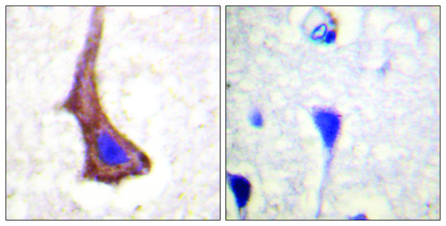 Anti-CSFR antibody produced in rabbit affinity isolated antibody