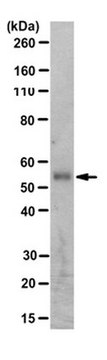 Anti-MDM2 Antibody, clone 4B2C1.11 clone 4B2C1.11, from mouse