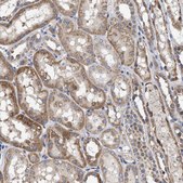 Anti-MALSU1 antibody produced in rabbit Prestige Antibodies&#174; Powered by Atlas Antibodies, affinity isolated antibody, buffered aqueous glycerol solution