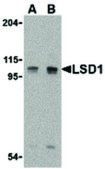 Anti-LSD1 antibody produced in rabbit affinity isolated antibody