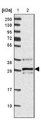 Anti-VTI1B antibody produced in rabbit Prestige Antibodies® Powered by Atlas Antibodies, affinity isolated antibody, buffered aqueous glycerol solution