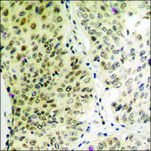 Anti-phospho-STK39 (pSer325) antibody produced in rabbit affinity isolated antibody