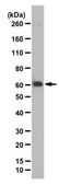 Anti-Zinc finger protein Eos Antibody from rabbit, purified by affinity chromatography