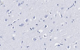 Anti-LC3A Antibody, clone 3J12 ZooMAb® Rabbit Monoclonal recombinant, expressed in HEK 293 cells