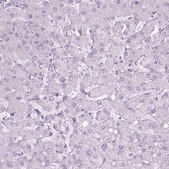 Anti-AQP10 antibody produced in rabbit Prestige Antibodies® Powered by Atlas Antibodies, affinity isolated antibody, buffered aqueous glycerol solution