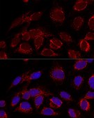 Anti-HADHA antibody produced in rabbit