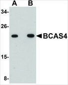Anti-BCAS4 antibody produced in rabbit affinity isolated antibody, buffered aqueous solution