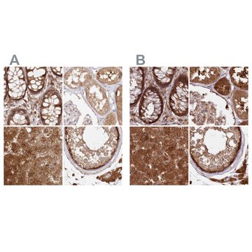 Anti-GBE1 antibody produced in rabbit Prestige Antibodies&#174; Powered by Atlas Antibodies, affinity isolated antibody, buffered aqueous glycerol solution