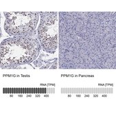 Anti-PPM1G antibody produced in rabbit Prestige Antibodies® Powered by Atlas Antibodies, affinity isolated antibody, buffered aqueous glycerol solution
