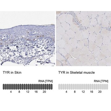 Anti-TYR antibody produced in rabbit Prestige Antibodies&#174; Powered by Atlas Antibodies, affinity isolated antibody, buffered aqueous glycerol solution