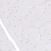 Monoclonal Anti-TYRP1 antibody produced in mouse Prestige Antibodies® Powered by Atlas Antibodies, clone CL4917, purified immunoglobulin, buffered aqueous glycerol solution