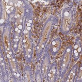 Anti-SLC11A1 antibody produced in rabbit Prestige Antibodies® Powered by Atlas Antibodies, affinity isolated antibody, buffered aqueous glycerol solution