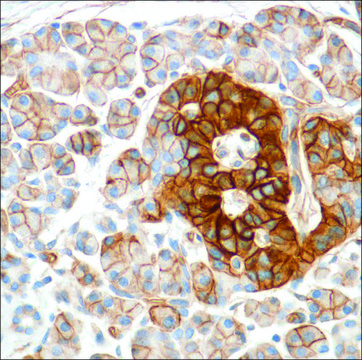 Anti-HENT1 antibody, Rabbit monoclonal clone SP120, recombinant, expressed in proprietary host, affinity isolated antibody