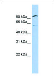 Anti-TMPRSS6 affinity isolated antibody