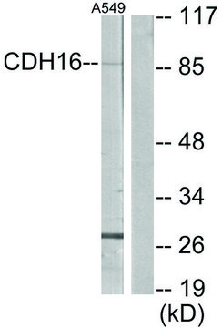 Anti-CDH16 antibody produced in rabbit affinity isolated antibody