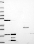 Anti-ELOB antibody produced in rabbit Prestige Antibodies® Powered by Atlas Antibodies, affinity isolated antibody, buffered aqueous glycerol solution