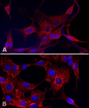 Anti-Superoxide Dismutase (MnSOD) (DD-17) antibody produced in rabbit affinity isolated antibody, buffered aqueous solution