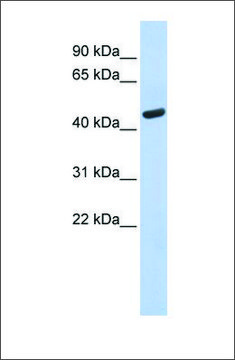 Anti-WARS antibody produced in rabbit affinity isolated antibody