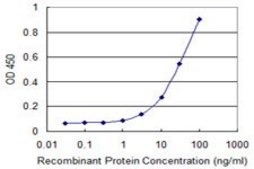 ANTI-FOXM1 antibody produced in mouse clone 2H4, purified immunoglobulin, buffered aqueous solution
