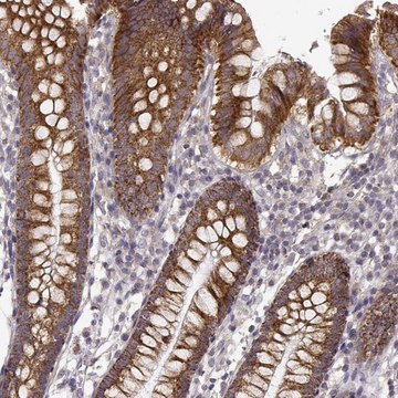 Anti-Erbb3 Antibody Produced In Rabbit Prestige Antibodies&#174; Powered by Atlas Antibodies, affinity isolated antibody, buffered aqueous glycerol solution