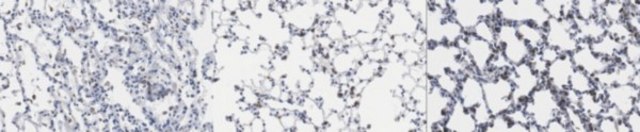 Anti-SFTPC Antibody from rabbit, purified by affinity chromatography