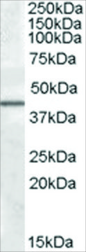 Anti-CAMK1D antibody produced in goat affinity isolated antibody, buffered aqueous solution