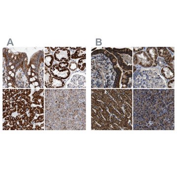 Anti-ETFA antibody produced in rabbit Prestige Antibodies&#174; Powered by Atlas Antibodies, affinity isolated antibody, buffered aqueous glycerol solution