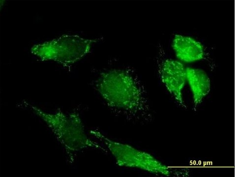 Anti-PDHX antibody produced in mouse IgG fraction of antiserum, buffered aqueous solution