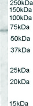 Anti-MTM1 antibody produced in goat affinity isolated antibody, buffered aqueous solution