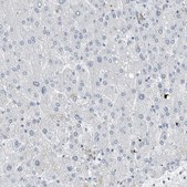 Anti-FABP6 antibody produced in rabbit Prestige Antibodies® Powered by Atlas Antibodies, affinity isolated antibody, buffered aqueous glycerol solution