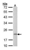 Anti-AP1S2 antibody produced in rabbit affinity isolated antibody, buffered aqueous solution