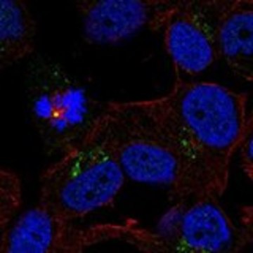 Anti-TRPM1 antibody produced in rabbit Prestige Antibodies&#174; Powered by Atlas Antibodies, affinity isolated antibody, buffered aqueous glycerol solution