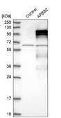 Anti-APBB2 antibody produced in rabbit Prestige Antibodies® Powered by Atlas Antibodies, affinity isolated antibody, buffered aqueous glycerol solution