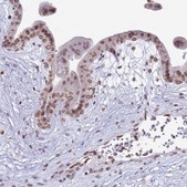 Anti-DHX37 antibody produced in rabbit Prestige Antibodies® Powered by Atlas Antibodies, affinity isolated antibody, buffered aqueous glycerol solution