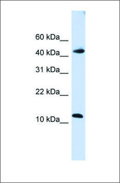 Anti-APOBEC3F antibody produced in rabbit affinity isolated antibody