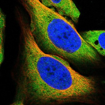 Anti-MCOLN1 antibody produced in rabbit Prestige Antibodies&#174; Powered by Atlas Antibodies, affinity isolated antibody, buffered aqueous glycerol solution