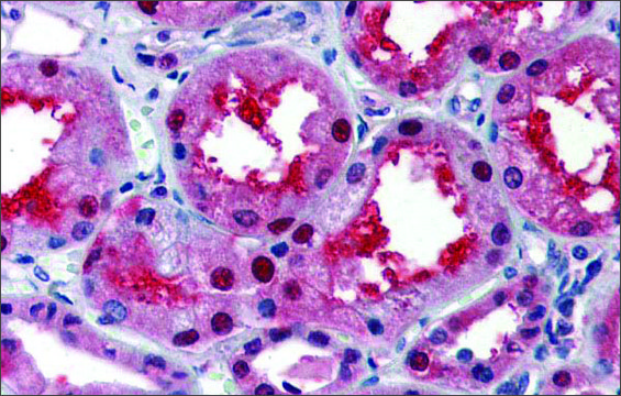 Anti-LASS2 (ab2) antibody produced in rabbit affinity isolated antibody