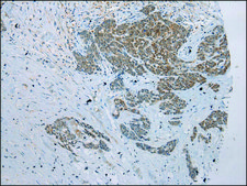 Anti-GSTM4 affinity isolated antibody