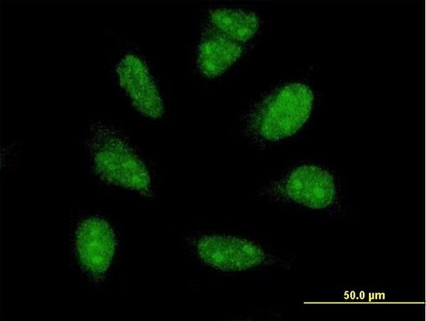 ANTI-PIM1 antibody produced in mouse clone 1C10, purified immunoglobulin, buffered aqueous solution