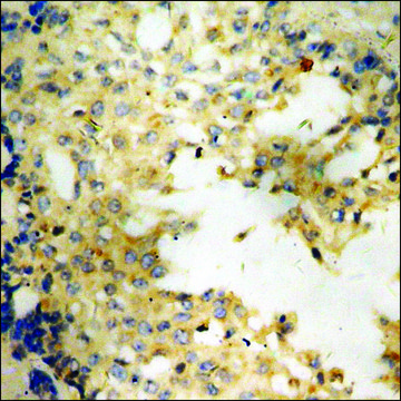 Anti-phospho-VEGFR1 (pTyr1048) antibody produced in rabbit affinity isolated antibody