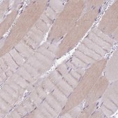 Anti-UBXN7 antibody produced in rabbit Prestige Antibodies® Powered by Atlas Antibodies, affinity isolated antibody, buffered aqueous glycerol solution