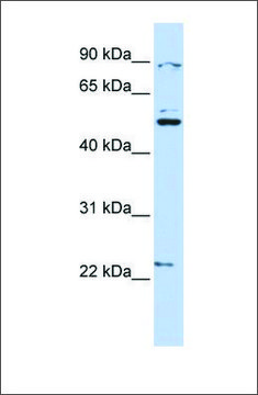 Anti-XK (ab2) antibody produced in rabbit affinity isolated antibody