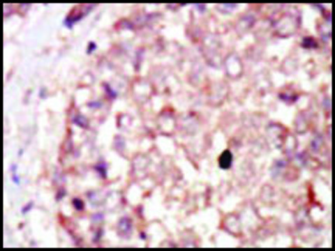 Anti-HIPK3 (C-term) antibody produced in rabbit IgG fraction of antiserum, buffered aqueous solution