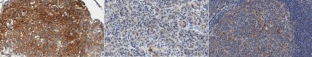 Anti-Src-Like-Adaptor 2 (SLA2) Antibody, clone Z30P1F12*F4 clone Z30P1F12*F4, from mouse