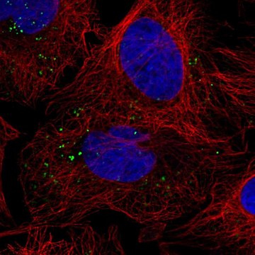 Anti-Vps25 Antibody Produced In Rabbit Prestige Antibodies&#174; Powered by Atlas Antibodies, affinity isolated antibody, buffered aqueous glycerol solution